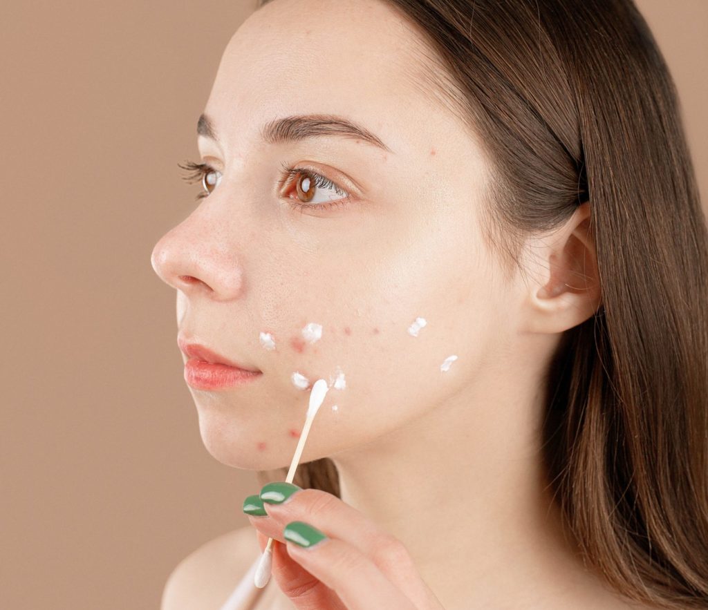 Here’s How To Heal A Breakout At Every Step