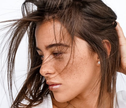Struggling With Hyperpigmentation? Here’s What You Need To Know!