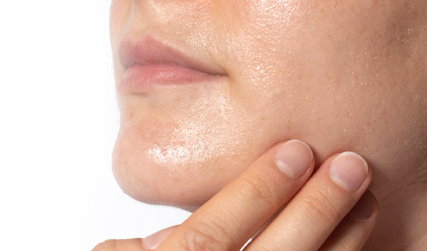 oily skin