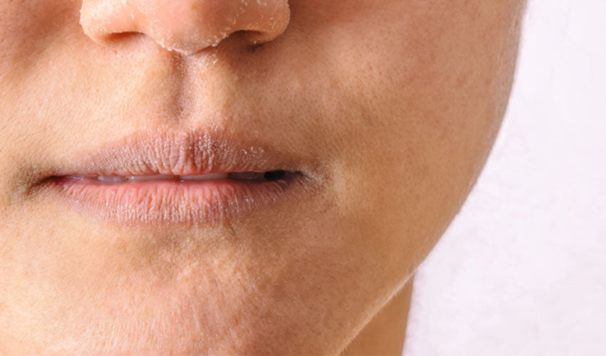 Best Skincare Products To Rejuvenate Dry Skin