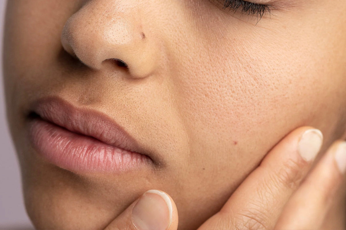 Dehydrated Skin: Learn The Signs And Boost Your Hydration Game