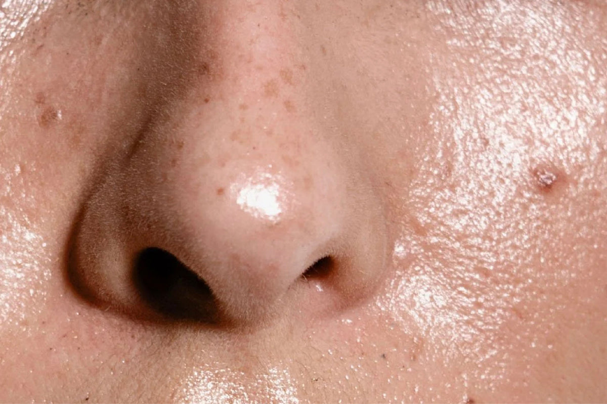 Oily Skin Woes? Discover Sunscreens That Don’t Clog Pores