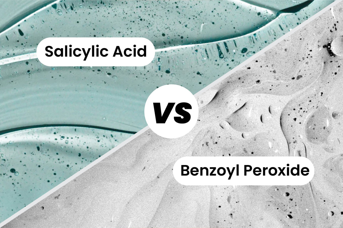 Salicylic Acid vs. Benzoyl Peroxide: Which One Is Right for Your Acne?