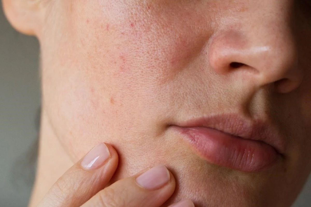 sebum control: Myths Vs facts