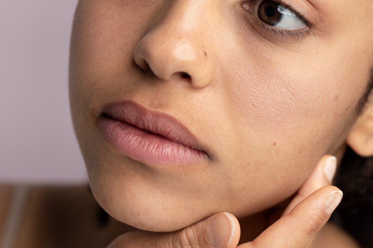 how to prevent clogged pores in monsoons