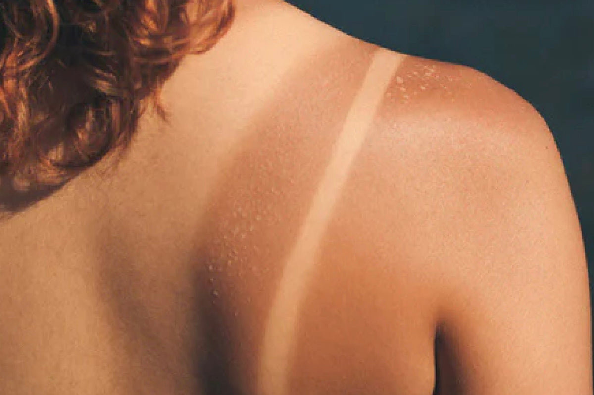 How To Remove Tanning From The Body? 3 Pro Ways That Always Work