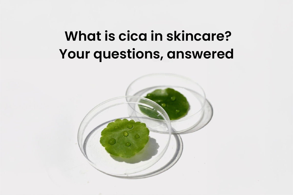 What is cica?