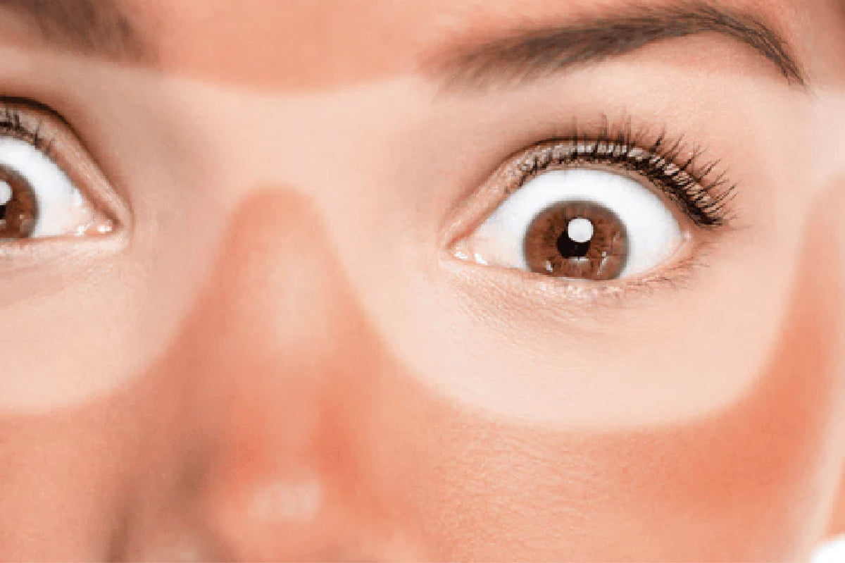 What Is Tan on The Skin? Know Its Underlying Causes & Possible Solutions!