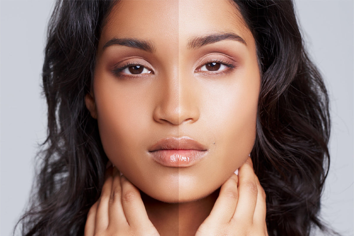 how to remove long-term tanning