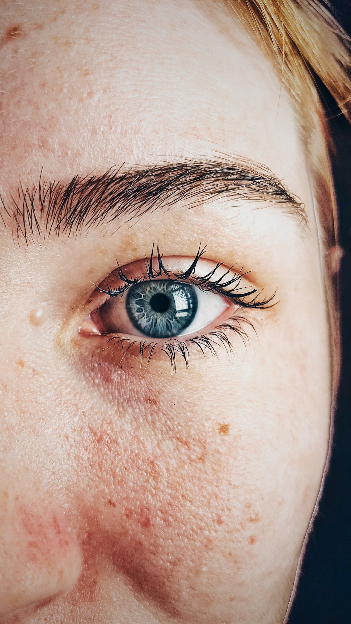 Know the Causes of Dry skin