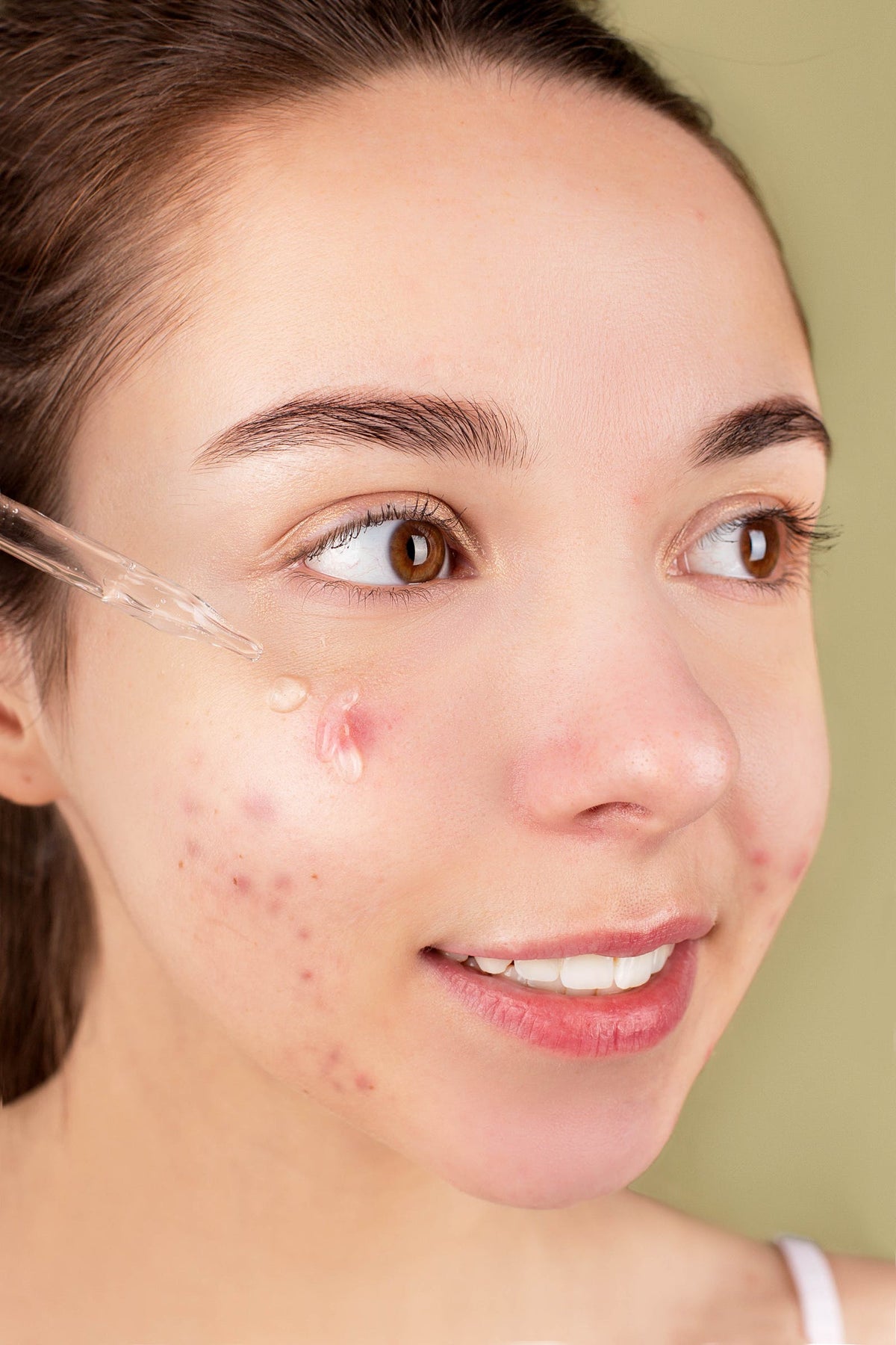 Vitamin C for Acne Scars: How and When to Use