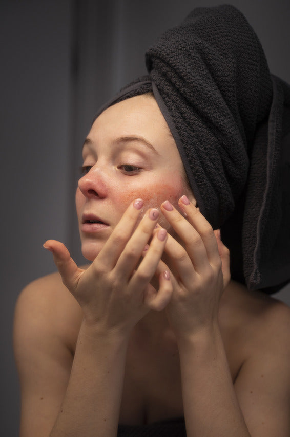 How To Use Niacinamide For Sensitive Skin