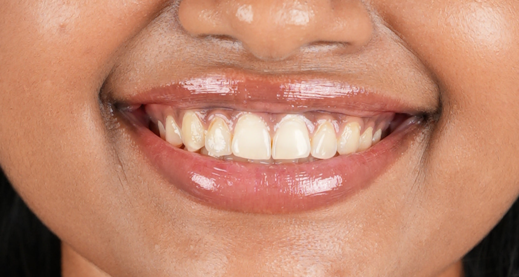 Before image of product effect