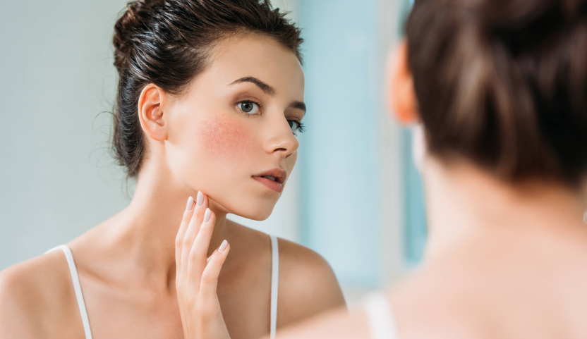 Guide to Understanding and Taking Care of Sensitive Skin