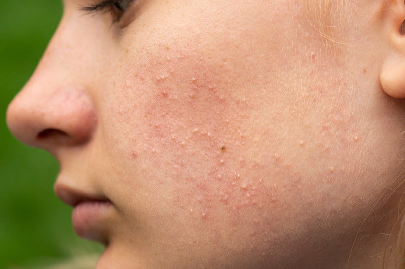 Best Products For Sensitive Skin