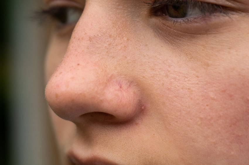 Best Ingredients  For Combination Skin