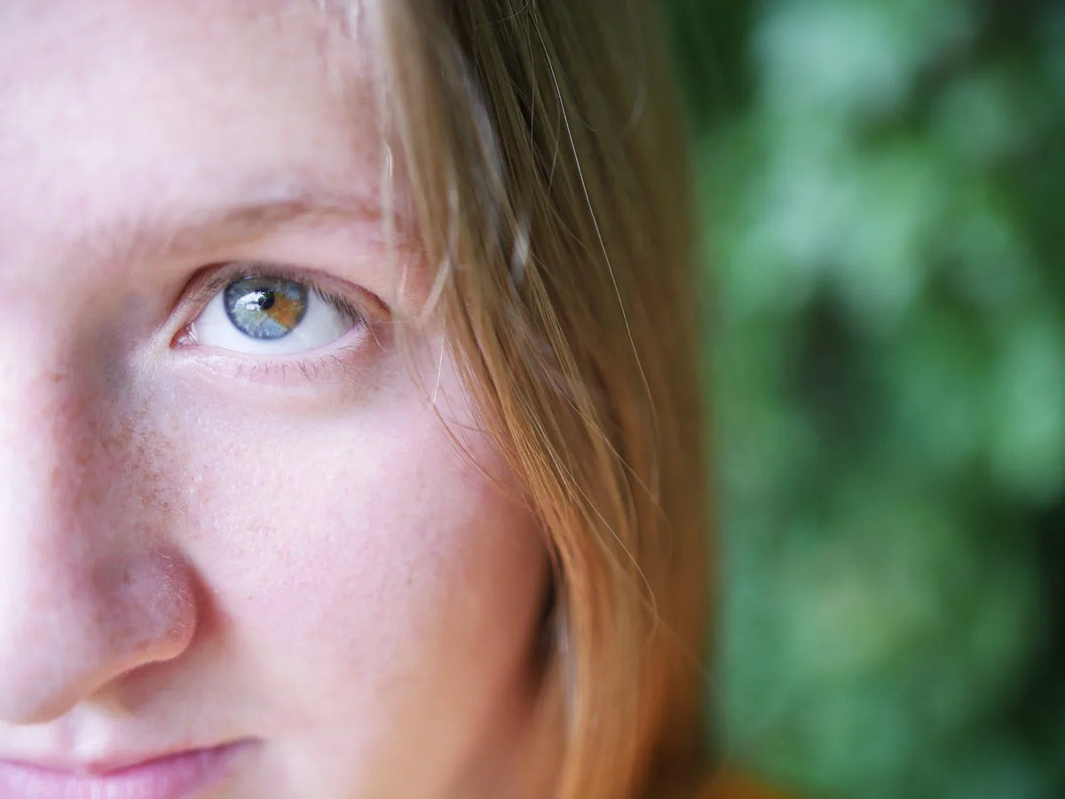 Know How to Reduce Eye Puffiness