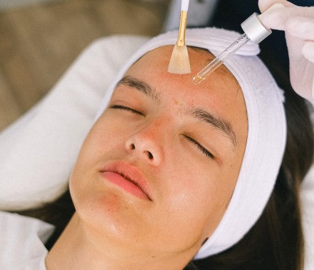 Chemical peels: Are they worth the hype? Which should you pick?