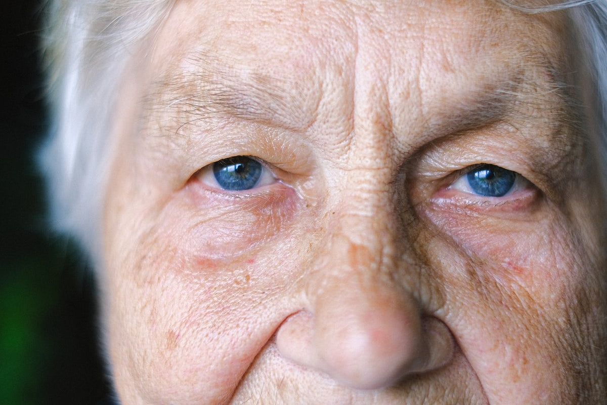 Discover the Difference Between Fine Lines and Wrinkles