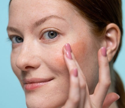 The difference between a rosy flush and angry skin, explained