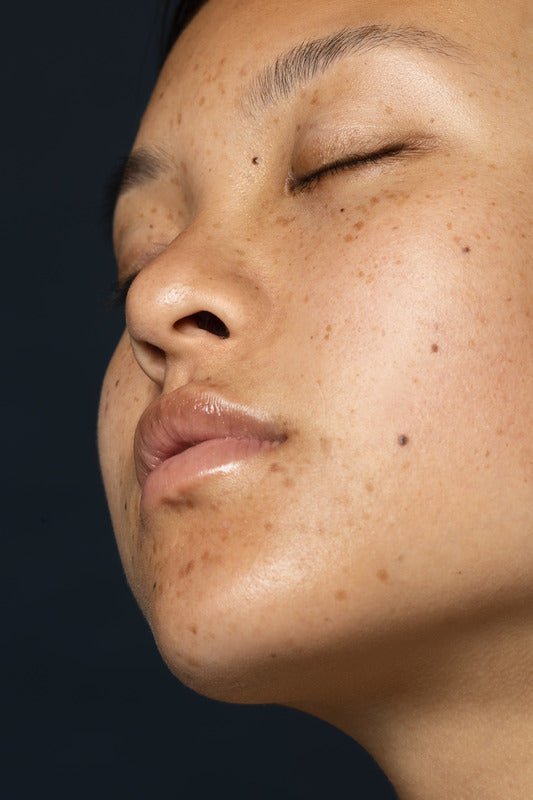 Pigmentation
