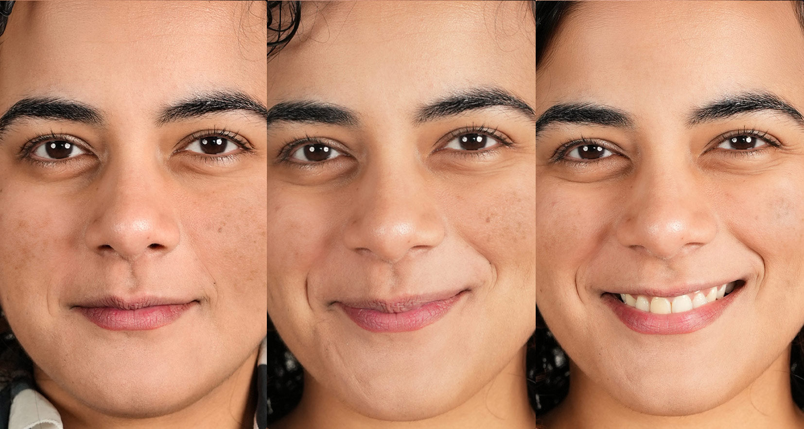 Before image of product effect