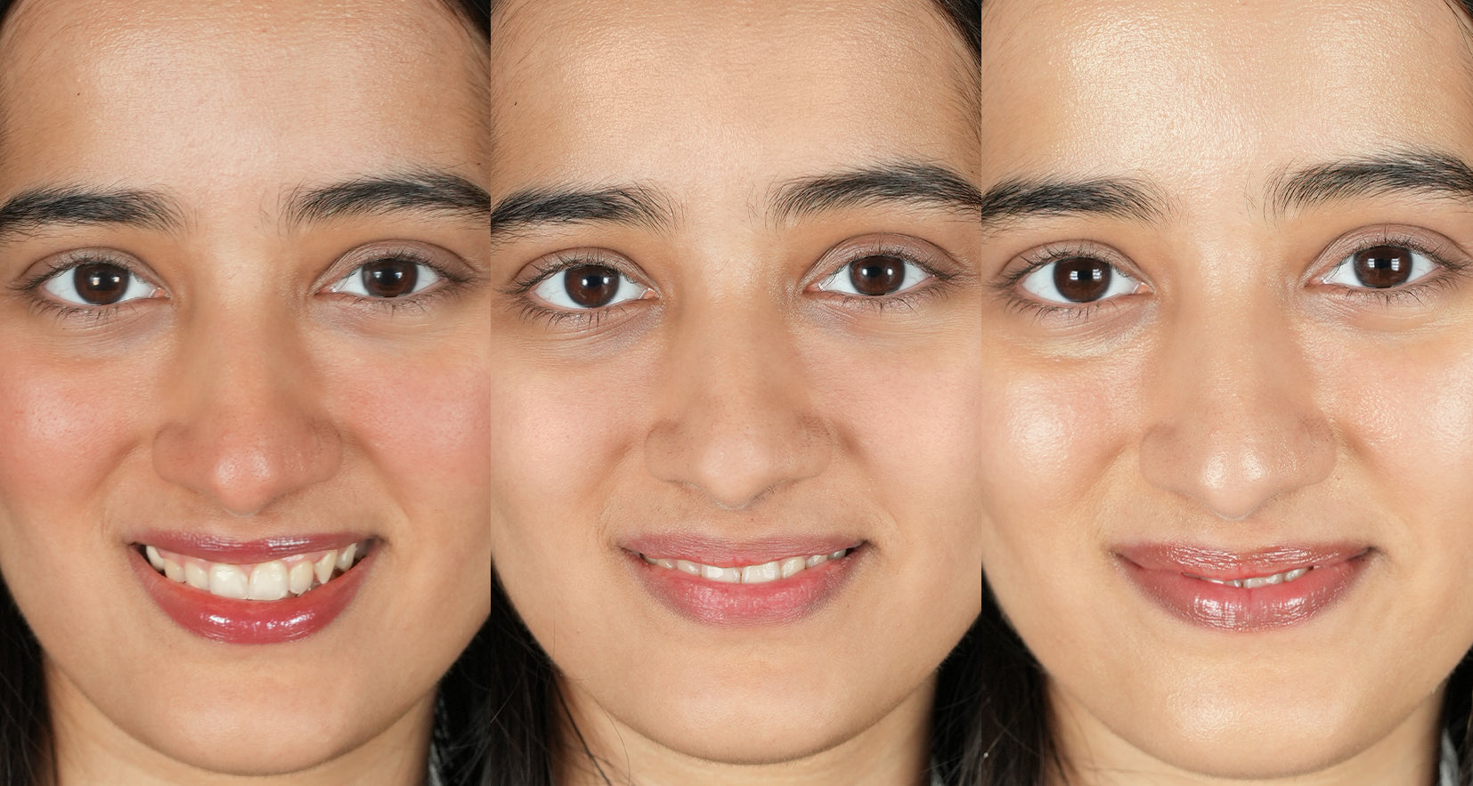Before image of product effect