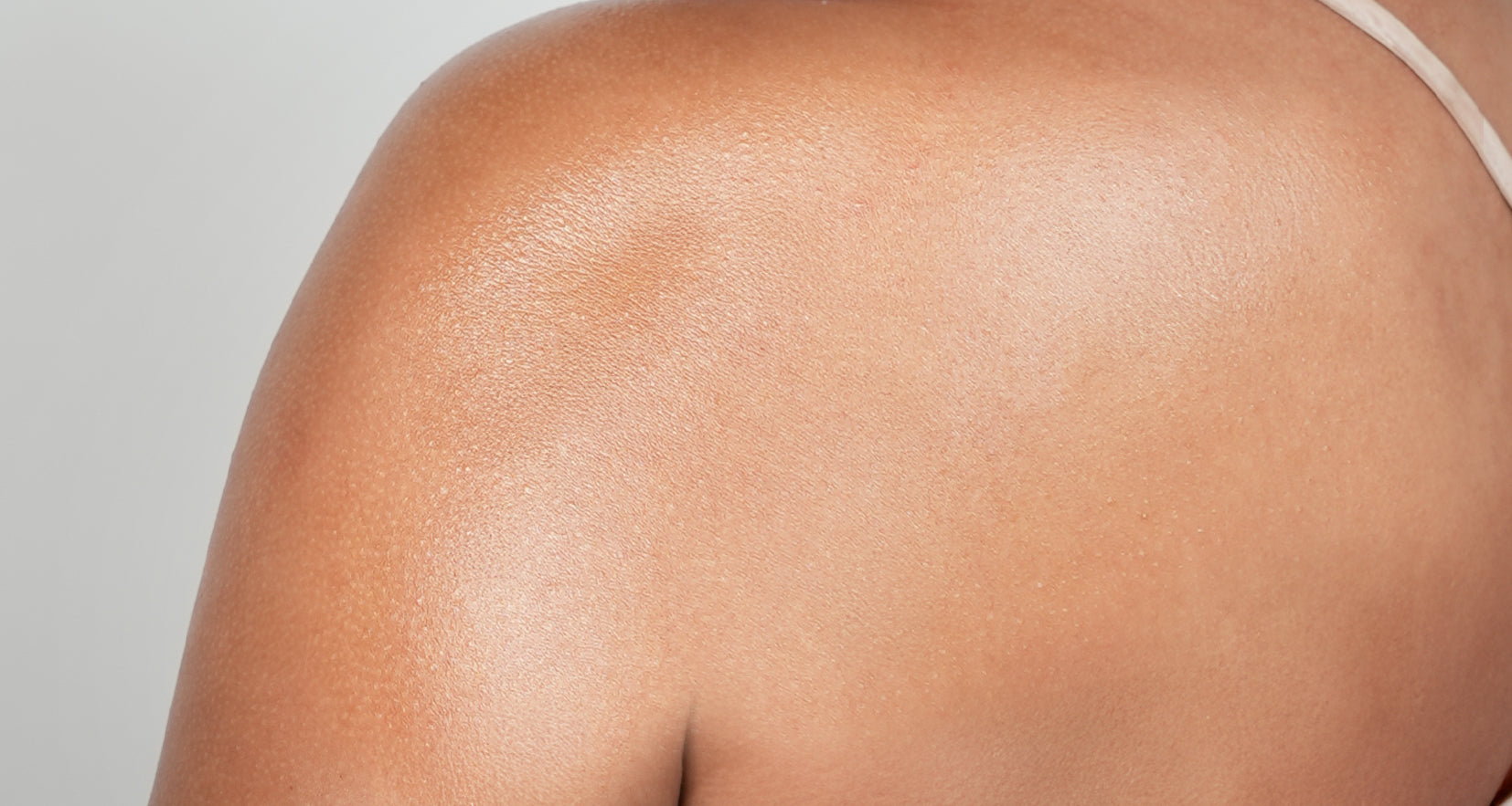 Before image of product effect