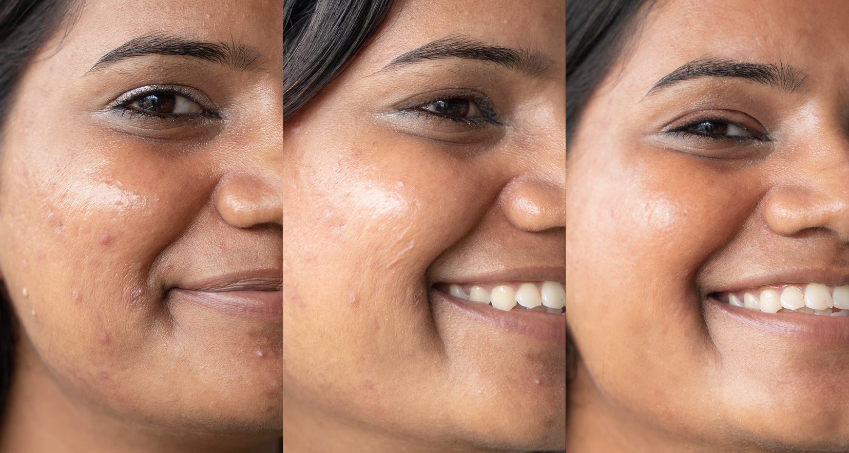 Before image of product effect