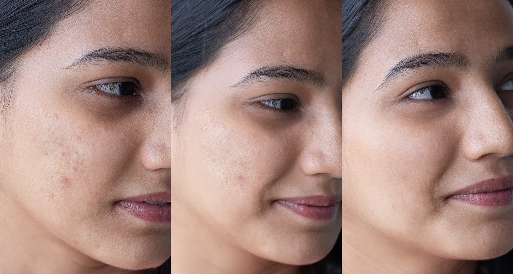 Before image of product effect