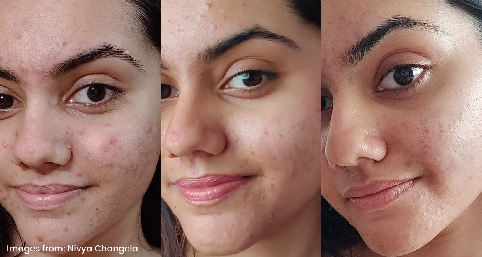 Before image of product effect