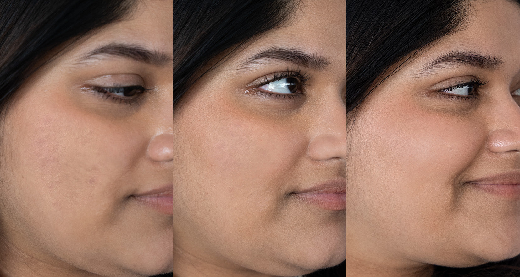 Before image of product effect