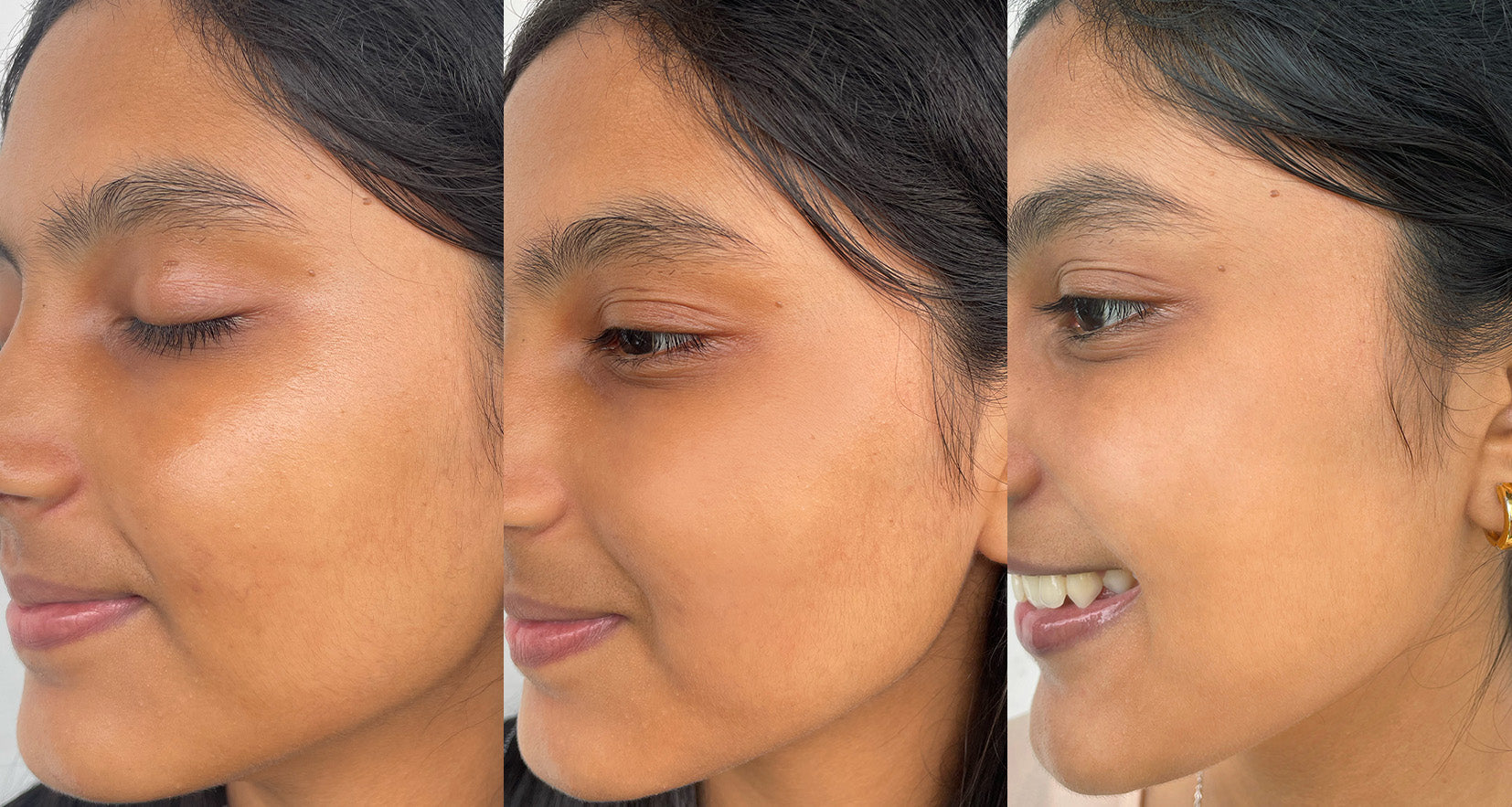 Before image of product effect