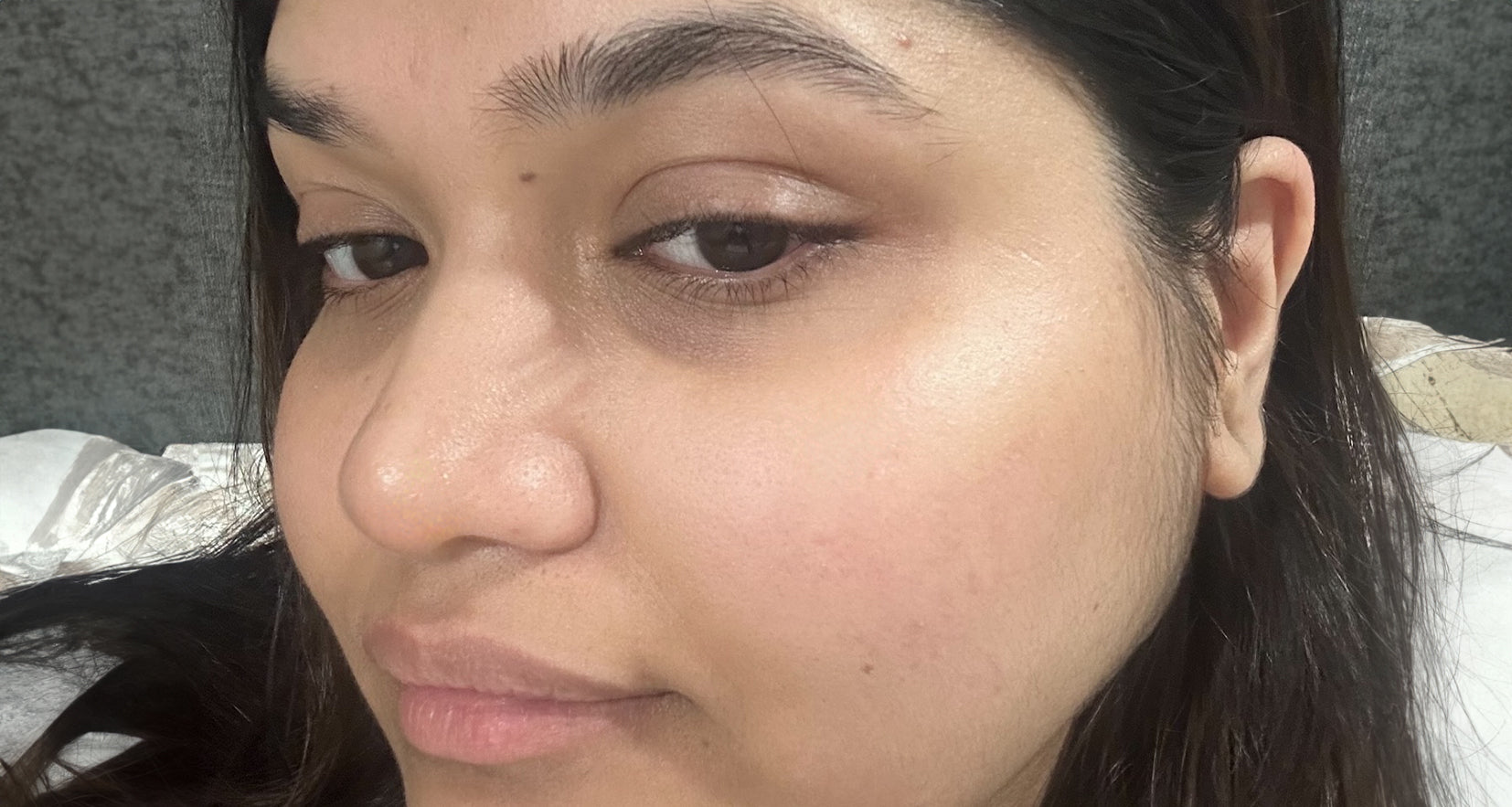 Before image of product effect