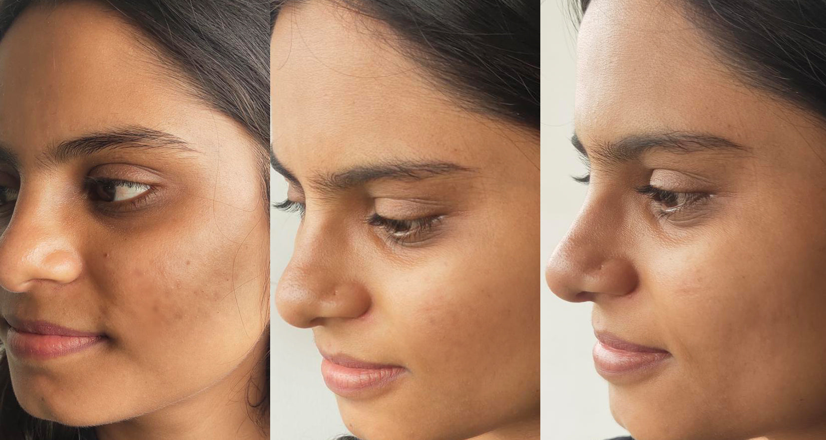 Before image of product effect